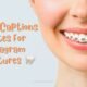 Braces Captions Quotes For Instagram
